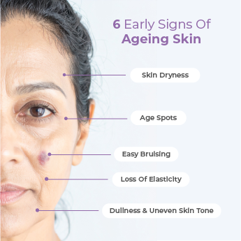 6 Early signs of Ageing Skin